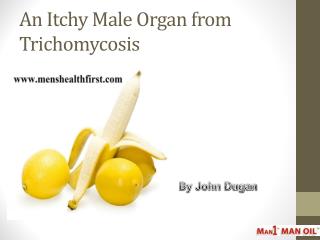 An Itchy Male Organ from Trichomycosis