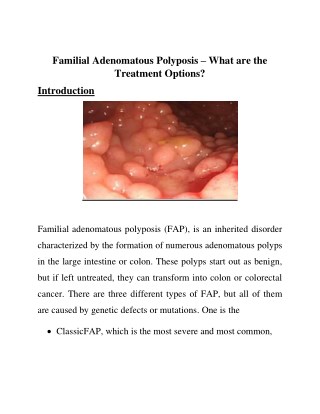 Familial Adenomatous Polyposis – What are the Treatment Options?