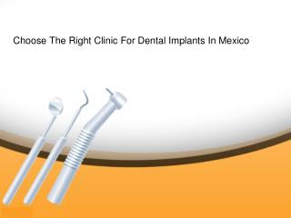 Mexico dentists|Tijuana Dentists: Choose The Right Clinic For Dental Implants In Mexico