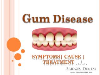 Schedule an Appointment with Brandon Dentist For Gum Treatment
