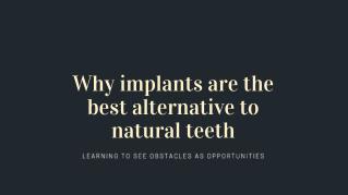 Why implants are the best alternative to natural teeth