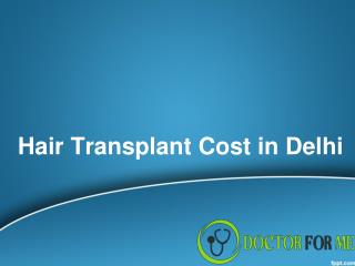 Hair Transplant Cost in Delhi