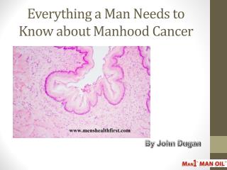 Everything a Man Needs to Know about Manhood Cancer