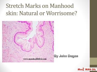 Stretch Marks on Manhood skin: Natural or Worrisome?