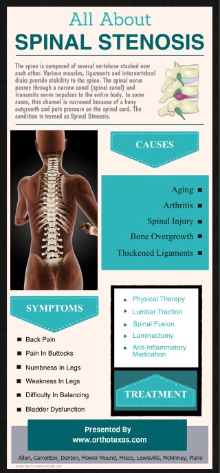 All About Spinal Stenosis