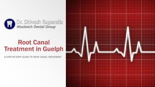 Step by Step Guide to Root Canal Treatment In Guelph