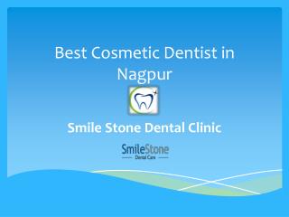 Best Cosmetic Dentist in Nagpur