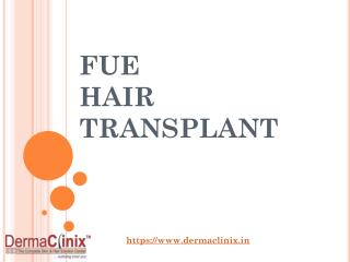 About FUE Hair Transplantation