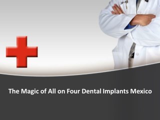 The Magic of All on Four Dental Implants Mexico