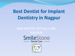 Best Dentist for Implant Dentistry in Nagpur