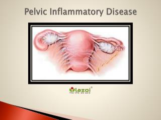 Pelvic Inflammatory Disease: Symptoms, causes, diagnosis, treatment and prevention