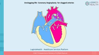 Unclogging life- Coronary Angioplasty for clogged arteries