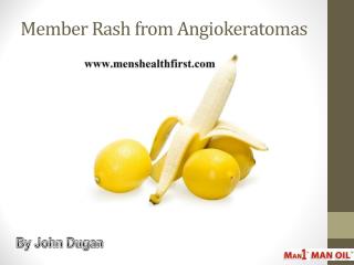 Member Rash from Angiokeratomas