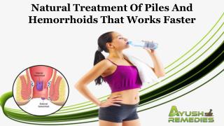 Natural Treatment of Piles and Hemorrhoids that Works Faster