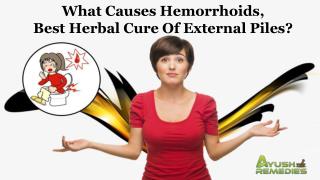What Causes Hemorrhoids, Best Herbal Cure of External Piles?
