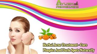 Herbal Acne Treatment - Cure Pimples and Dark Spots Naturally