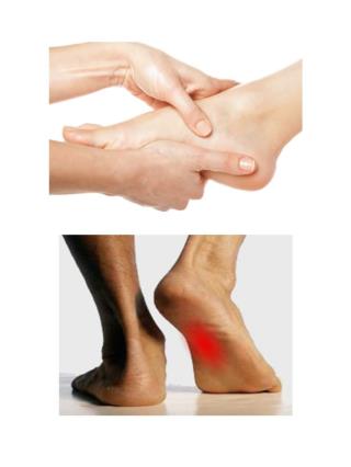 Pain In Arch Of Foot, Severe Heel Pain, Best Running Shoes For Plantar Fasciitis, Foot Pain Heel