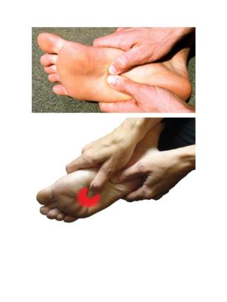 Plantar Fasciitis Pain Relief In Just 5 Minutes and Get Permanent Relief in Just 7 days