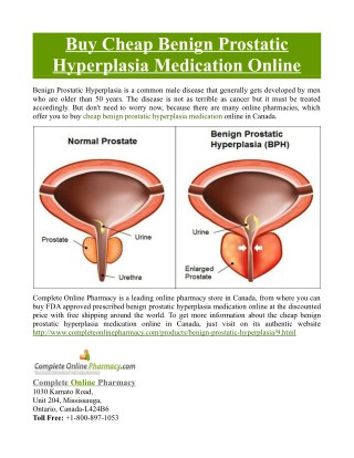 Buy Cheap Benign Prostatic Hyperplasia Medication Online