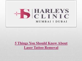 5 Things You Should Know About Laser Tattoo Removal