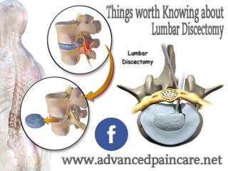 Things worth Knowing about Lumbar Discectomy