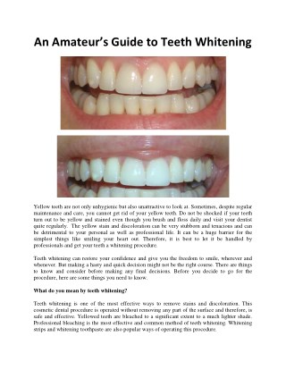 An Amateur’s Guide to Teeth Whitening