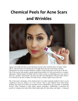 Chemical Peels for Acne Scars and Wrinkles