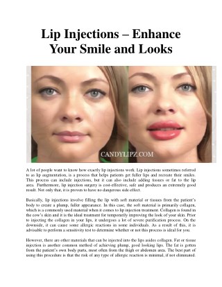 Lip Injections – Enhance Your Smile and Looks