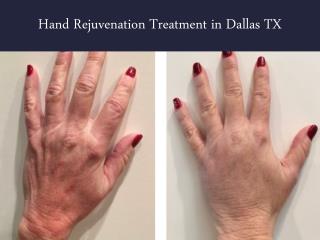 Hand Rejuvenation Treatment in Dallas TX