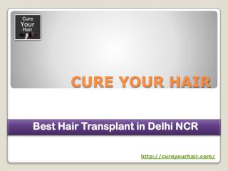Best Hair Transplant In Delhi NCR