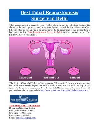 Best Tubal Reanastomosis Surgery in Delhi