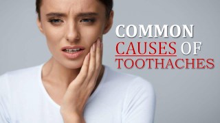 Common Causes of Toothaches