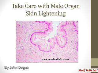 Take Care with Male Organ Skin Lightening