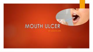 Treatment of Mouth Ulcer by Must4care