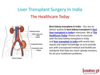 Liver Transplant Surgery In India