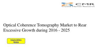 Optical Coherence Tomography Market- Analysis Including Size, Share, Market Key Trends & Industry Forecast 2016- 2025