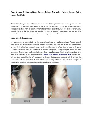 Take A Look At Korean Nose Surgery Before And After Pictures Before Going Under The Knife