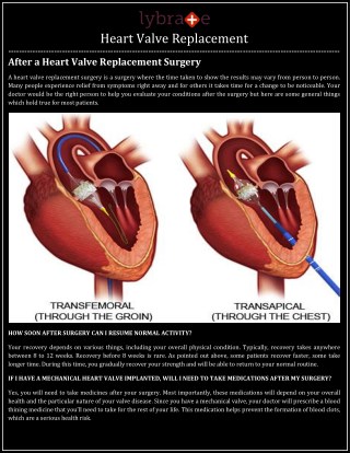 Heart Valve Replacement - Lybrate