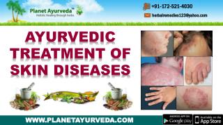 Ayurvedic Treatment of Skin Diseases - Types, Causes, Symptoms