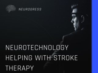 Neurotechnology Helping with Stroke Therapy