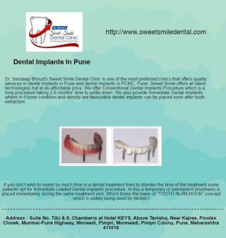 Dental Implants in Pune - Dr. Sandeep Bhirud | Sweet Smile Dental