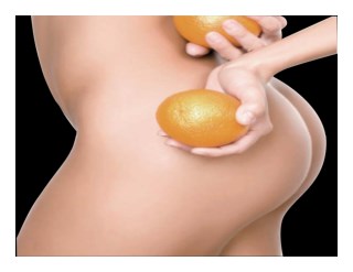 Comment Perdre La Peau D Orange, Masseur Anti Cellulite, Tisane Anti Cellulite, Stop Cellulite