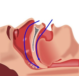 Snoring Illustration