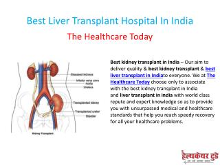 Best Liver Transplant Hospital In India