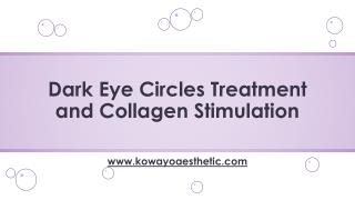 Dark Eye Circles Treatment