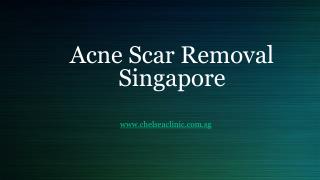 Acne Scar Removal Singapore
