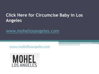 Click Here for Circumcise Baby in Los Angeles - www.mohellosangeles.com