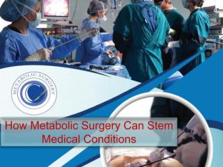 How Metabolic Surgery Can Stem Medical Conditions