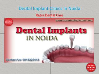 Dental Implant Clinics In Noida