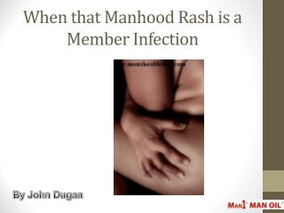 When that Manhood Rash is a Member Infection